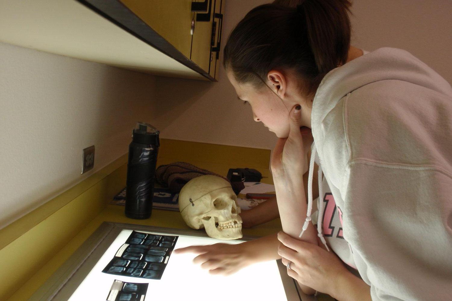 法医人类学学生妮可·阿里兹门迪通过比对牙齿记录来识别一具人类骨骼.
